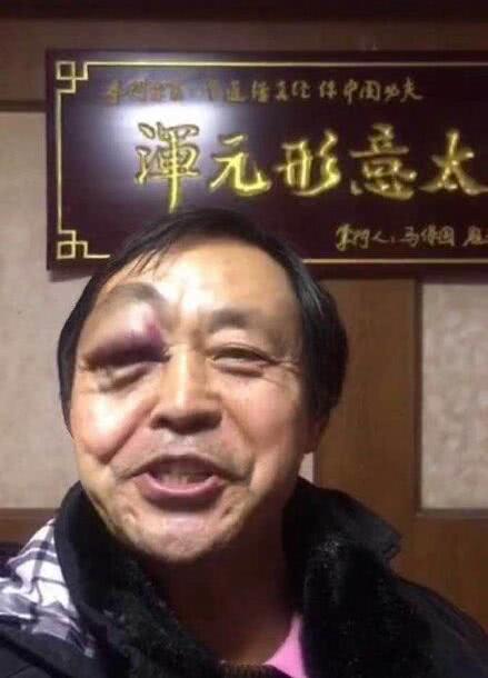 马保国最新爆料新闻视频,揭秘武术界惊人内幕! 第3张 马保国最新爆料新闻视频,揭秘武术界惊人内幕! 第3张